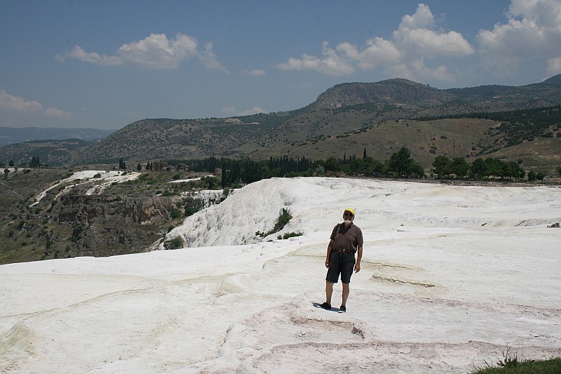  cataratte 